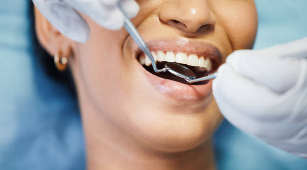 Best Urgent Dental Care for Toothache in Huntsville, TX